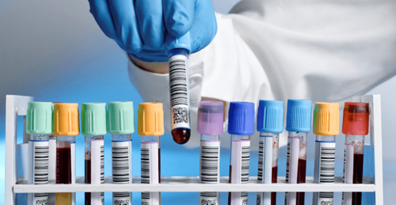 Synevo (синэво) Кривой Рог