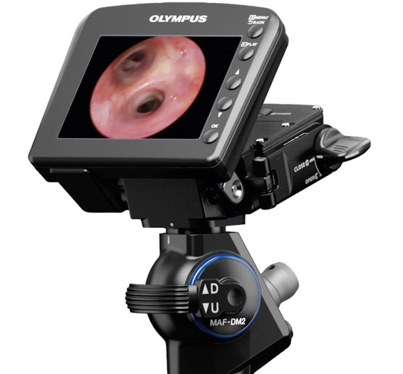 відеобронхоскоп